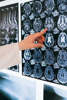 rack my brain