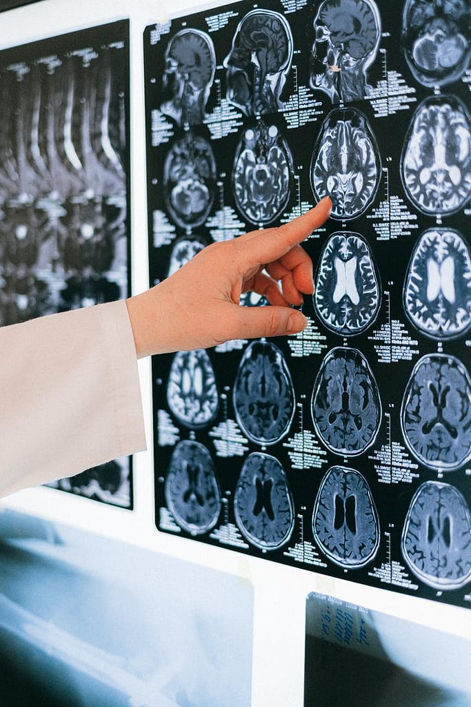 rack my brain